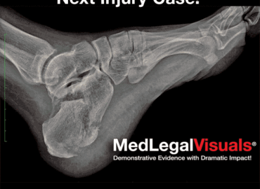 MedLegalVisuals, LLC